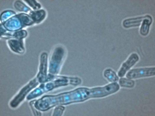 В дрожжевых клетках, показанных здесь, белок Dicer защищает ДНК (ярко-синего цвета), помогая разрешать конфликты между транскрипцией и репликацией. Если не контролировать эти конфликты, они могут нарушить оба процесса. Фото: Martienssen lab/CSHL